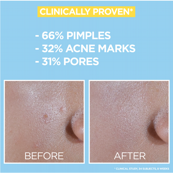 Garnier Daily UV Niacinamide Anti-Imperfection Fluid SPF50+ 40ml